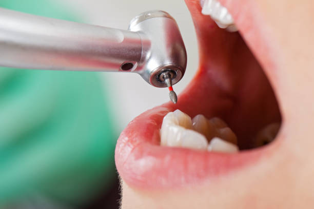 Best Emergency Gum Treatment in Primera, TX